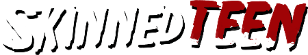 skinnedteen